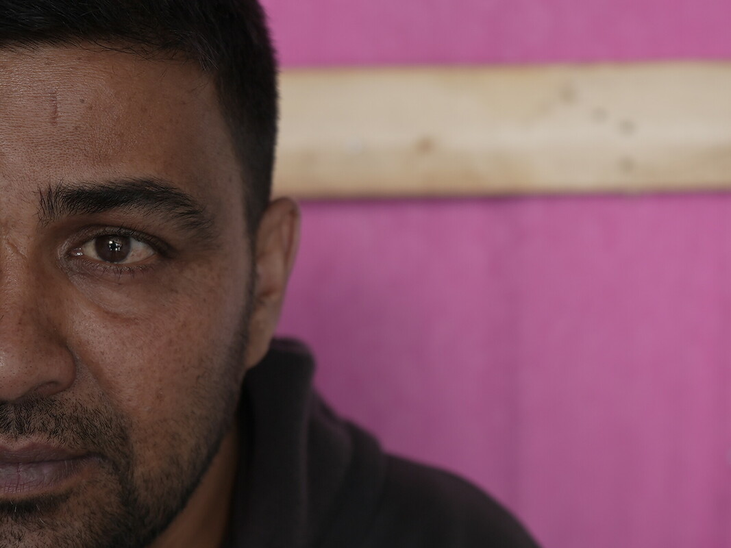 Gli occhi di Ibrahim sono pieni di dolore e tristezza. Foto: Alef Multimedia/Oxfam