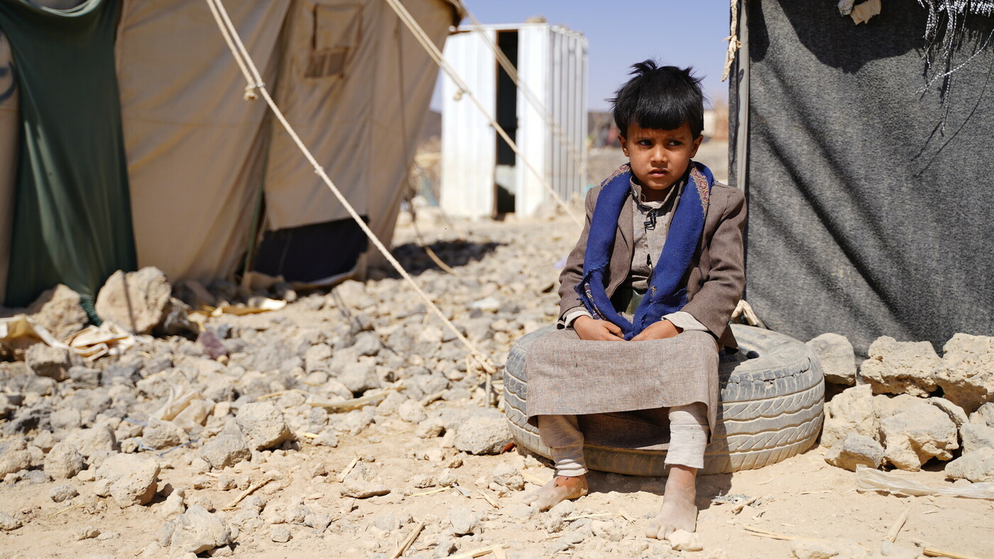 Foto di Omar, bambino seduto tra le macerie a causa della guerra in Yemen